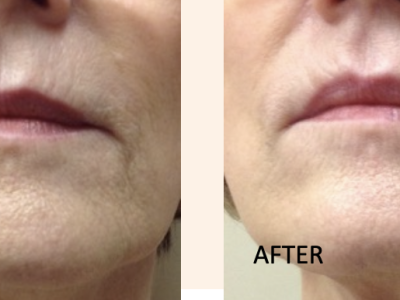 Screenshot 2025-03-04 at 5.35.29 PM